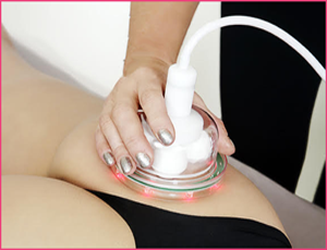 cellulite removal beverly hills