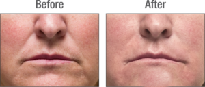 men's facials oklahoma city